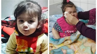 حقيقة تعرض طفلة لوعكة صحية شديدة في الغربية عقب تناولها لـ الإندومي