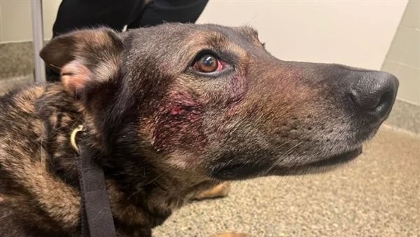 أثار العض تظهر على