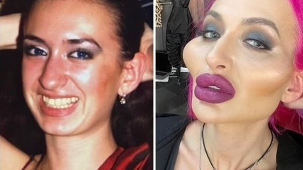 أناستاسيا قبل وبعد