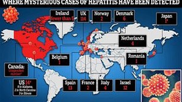 التهاب الكبد الوبائي