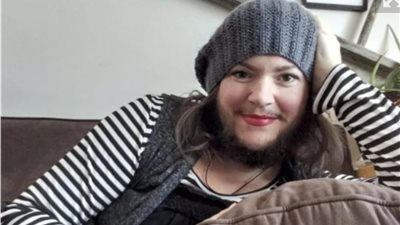 فتاة كندية تعاني من شعر الذقن: كنت أحلق لحيتي كل يومين| صور