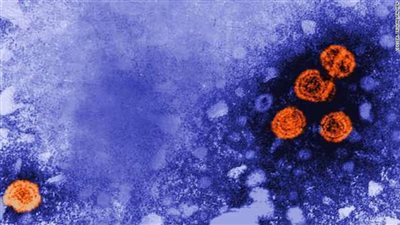 خبير مناعة يوضح الطرق الوقائية لتجنب إصابة الأطفال بـ التهاب الكبد الوبائي