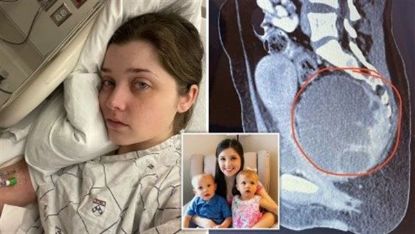 الفتاة المصابة 