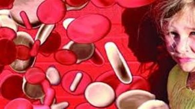 هذه الخطوات تكشف عن وجود مرض الثلاسيميا عند طفلك