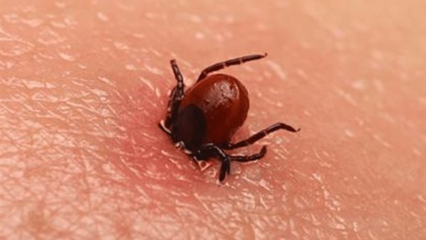 مرض لايم في كندا