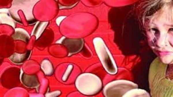 مرض الثلاسيميا