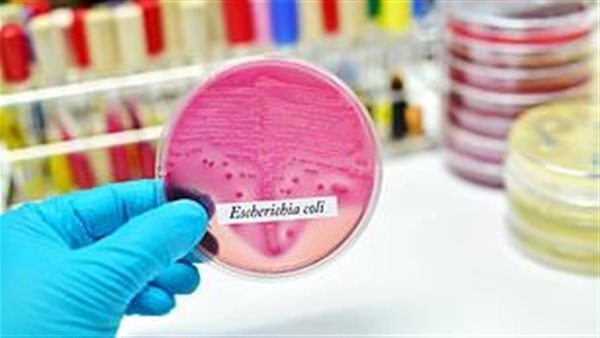 لقاح المسالك البولية