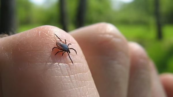 الإصابة بفيروس نادر