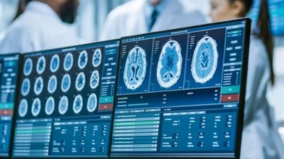 أضرار أشعة الصبغة على الجسم.. الفشل الكلوي والتسمم العصبي أخطر المضاعفات