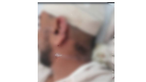 الشاب المصاب 