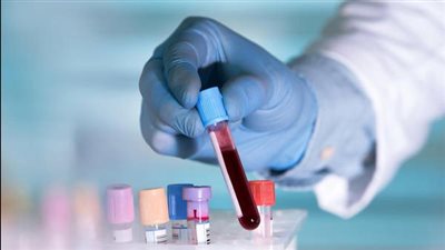 الرعاية الصحية: عيادة أمراض الدم من أهم الخدمات المقدمة بمستشفى المبرة بورسعيد