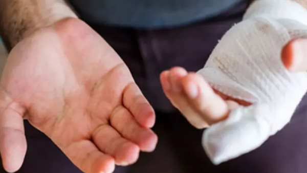 قضم إصبع مدير