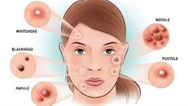 أنواع الحبوب