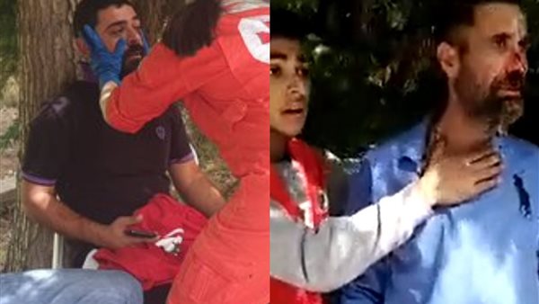 إصابة مندوب القوات