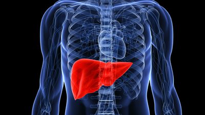 احذر.. علامات باليد تشير إلى إصابتك بتليف الكبد