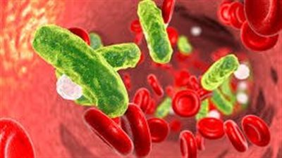 فقدان الوعي وحمّى شديدة.. تعرف على تسمم الدم وأعراضه