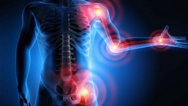 التهاب المفاصل