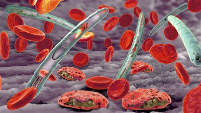 الصحة العالمية تعلن اتخاذ إجراءات عاجلة للقضاء على الملاريا في إفريقيا