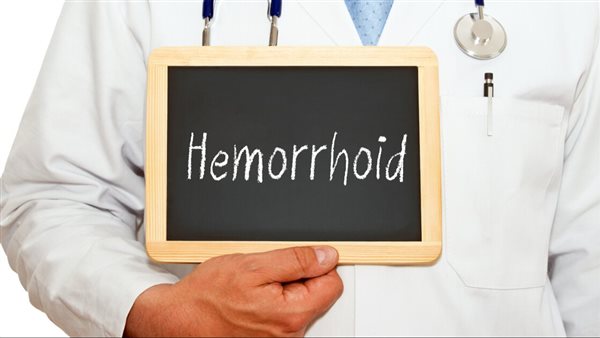 علاج البواسير نهائيا