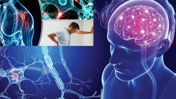 التصلب المتعدد 