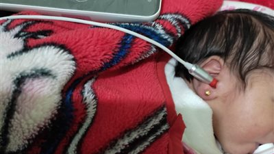 صحة الدقهلية: فحص 310 آلاف طفل منذ بدء الكشف المبكر عن ضعاف السمع للمواليد