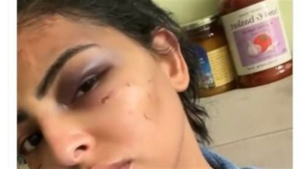 المصرية المغتصبة