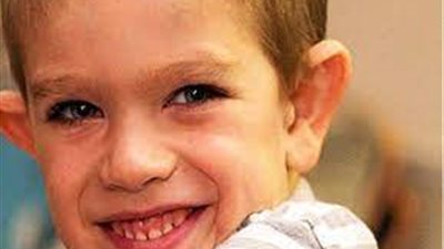 علامات تشير إلى إصابة طفلك بمتلازمة الهش.. فاحذرها