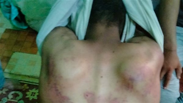 المجني عليه