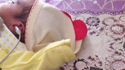 ضمن مبادرة السمعيات.. الكشف الطبي على 12 ألف طفل حديث الولادة بالمنيا