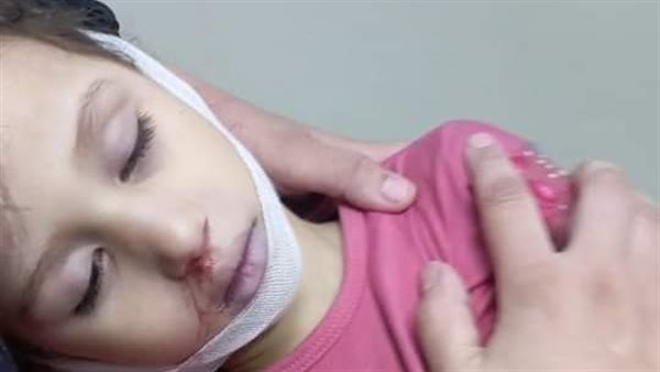 الطفلة فرحة - المجني