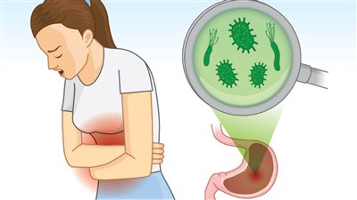 أسباب جرثومة المعدة.. 7 عوامل محفزة على الإصابة أهمها الطعام والماء الملوث