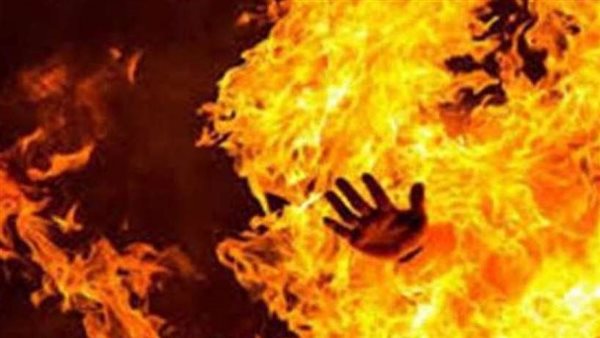 حرق ربة منزل - صورة
