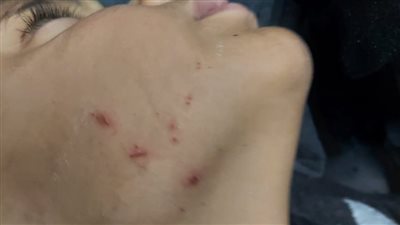 جمعية لرعاية مرضى التوحد تعذب الأطفال لاحتجازهم مدة أطول.. وأب: ابني رجعلي صابعه مقطوع