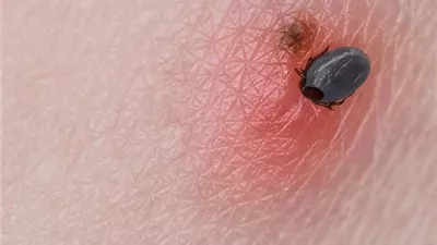 تحذير صحي في جامعة نيو إنجلاند الأمريكية بعد انتشار أمراض ينقلها القراد داخل الحرم الجامعي