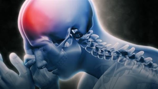 أسباب الصداع