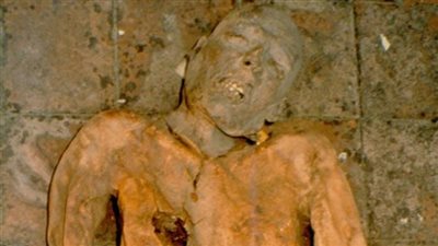 إعادة بناء جينوم قديم لبكتيريا قولونية من مرارة مومياء تعود للقرن الـ16