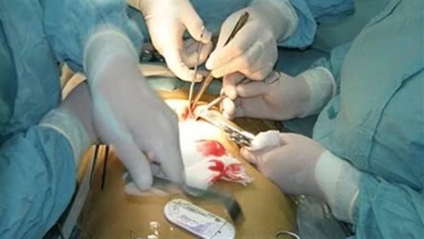 تجارة الأعضاء البشرية