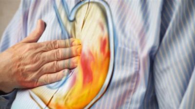 هل تعاني من الحموضة المتكررة؟.. إليك بعض العلاجات المنزلية التي يمكنك تجربتها