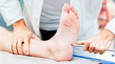 يؤثر على الذراعين والقدمين.. ما هو اعتلال الأعصاب؟ 