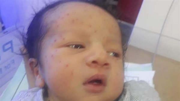 طفل حديث الولادة