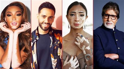 في يومه العالمي.. تعرف على مشاهير أصيبوا بمرض البهاق