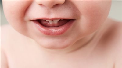 متى يكون الطفل متأخرا في التسنين وكيفية التعامل مع آلامه؟.. طبيب يوضح