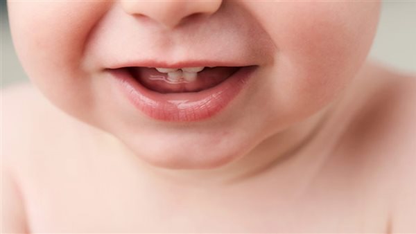 تسنين الأطفال