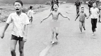 بعد مرور 50 عامًا على الصورة الأسطورية.. فتاة نابالم تتلقى العلاج النهائي لحروق الحرب │ صور