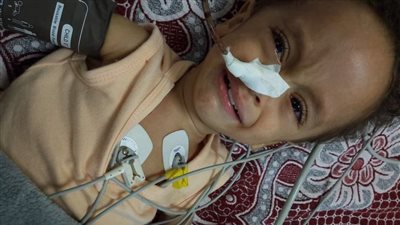 يحتاج لجهاز بـ 30 ألف جنيه.. أب يستغيث بالمسؤولين لعلاج ابنه من مرض الإسكندر النادر