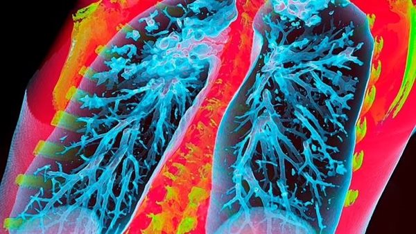 الرئتين -تعبيرية