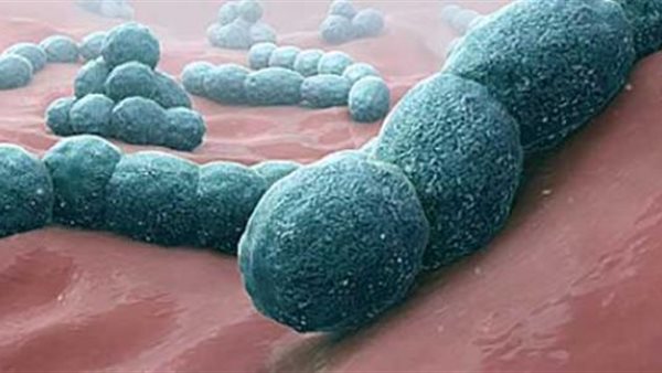 التهاب السحايا 