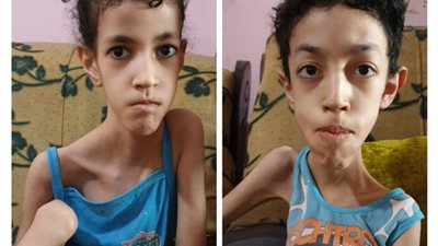 أمنيتي أشوفهم بيمشوا.. والدة طفلين تستغيث لعلاجهما من ضمور عضلي دوشين │ صور