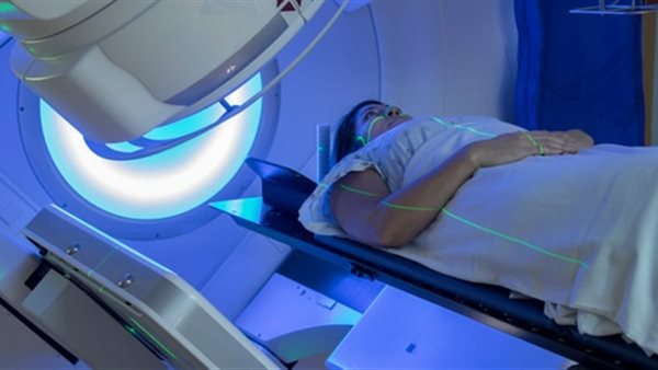 العلاج الاشعاعي