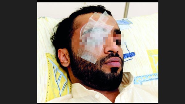 فقع عين_ أرشيفية